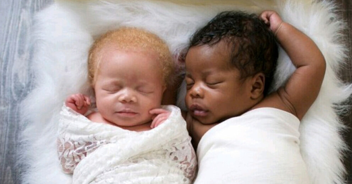 You are currently viewing There are black and white twins in a photographer’s family. Her photographs of her albino daughter are stunning.