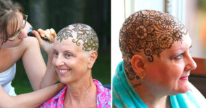 Read more about the article Beautiful Henna Designs Drawn on the Hairless Head of a Cancer Patient!